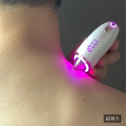 肩