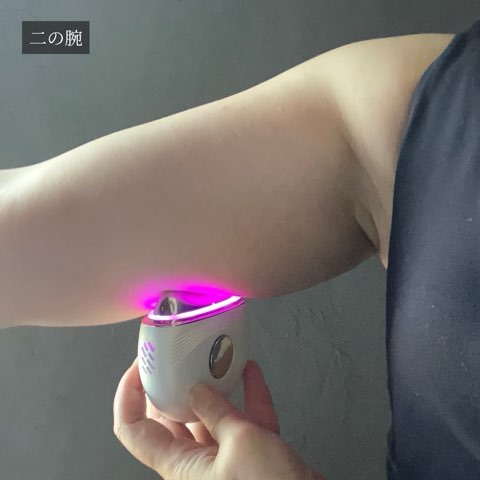 二の腕