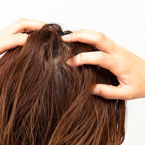 頭皮の乾燥と硬さが進行