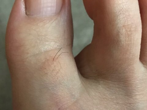 足の指の毛